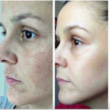 Load image into Gallery viewer, Korean Fairy Skincare™ 5 in 1 Face Lifting EMS/RF Massager