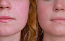 Load image into Gallery viewer, Korean Fairy Skincare™ 5 in 1 Face Lifting EMS/RF Massager