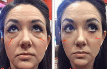 Load image into Gallery viewer, Korean Fairy Skincare™ 5 in 1 Face Lifting EMS/RF Massager